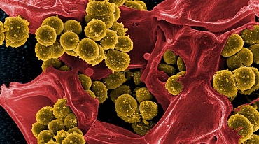 В борьбе с пластмассой помогут бактерии